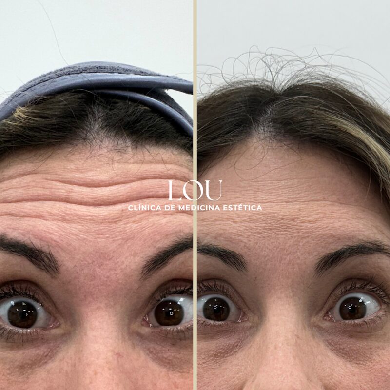 Imagen de Clínica Lou – Medicina Estética