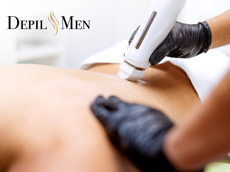 Imagen de Depilmen