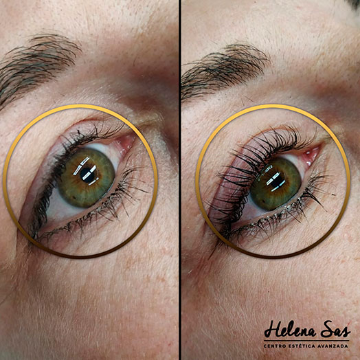 Imagen de Helena Sas – Clínica Médico Estética en la Eliana