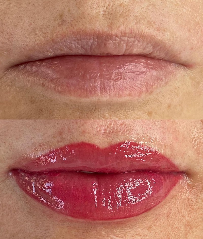 Imagen de Maderoterapia San Vicente del Raspeig – Microblading San Vicente del Raspeig – Mia Magic