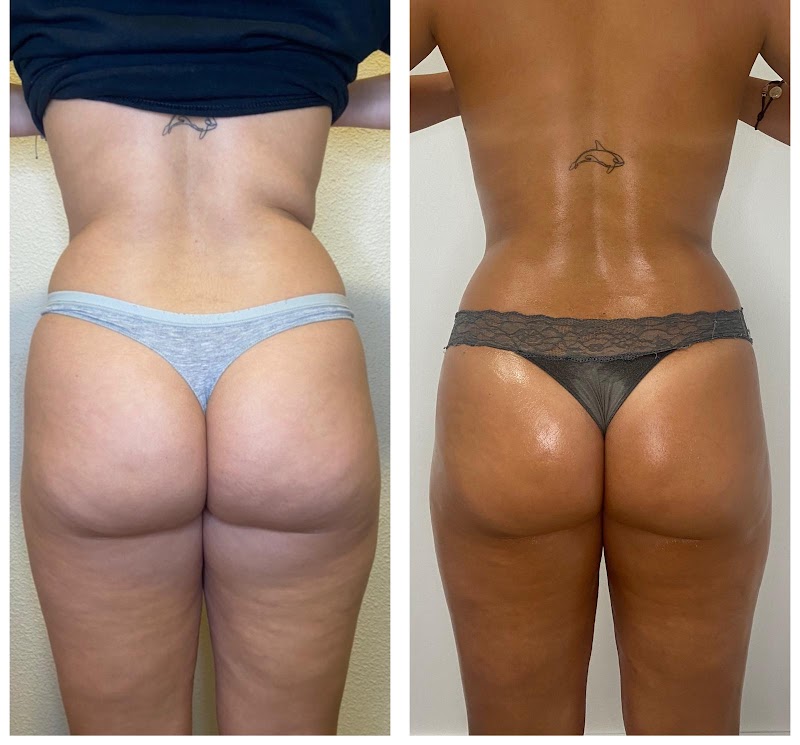 Imagen de Maderoterapia San Vicente del Raspeig – Microblading San Vicente del Raspeig – Mia Magic