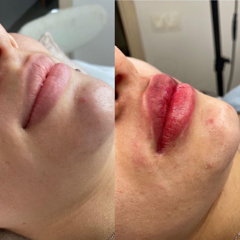 Imagen de Maderoterapia San Vicente del Raspeig – Microblading San Vicente del Raspeig – Mia Magic