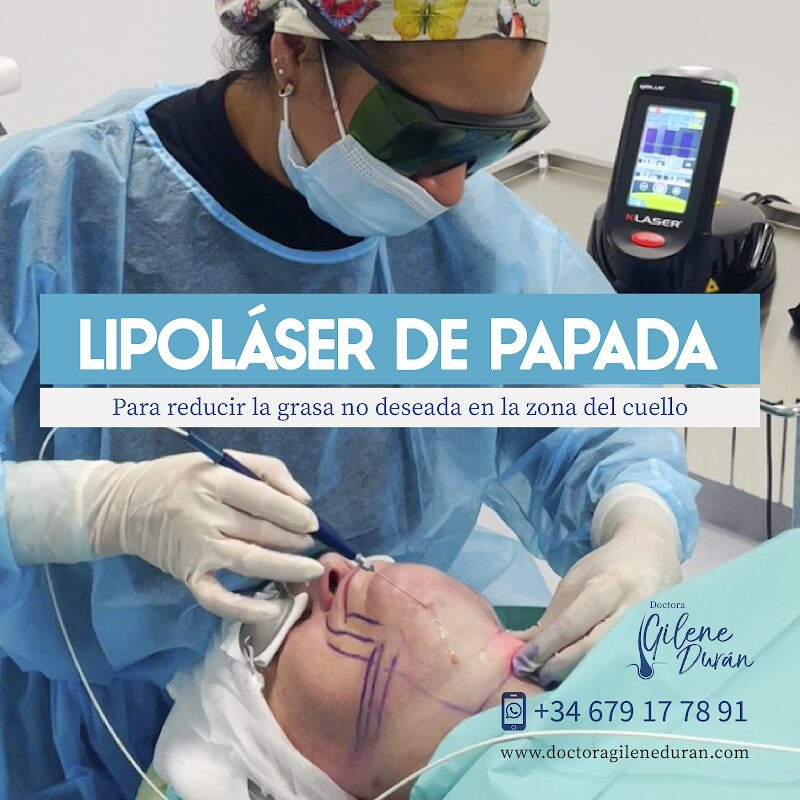 Imagen de Dra Gilene Durán, Especialista en Lipopada con Láser, Medicina Estética y Cirugía Capilar Madrid