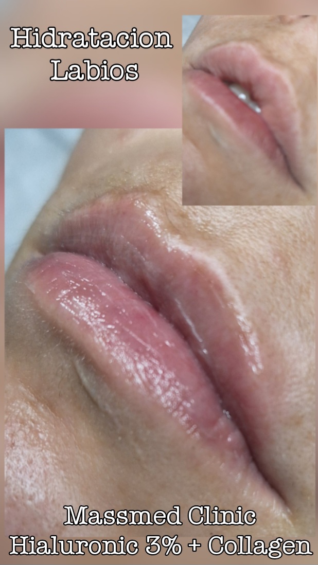 Imagen de Nuriapeña Estética Avanzada