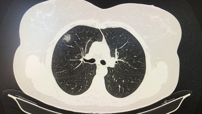 Imagen de Clinica Dr. German Saez Roca, Neumologo-apnea del Sueño-asma Grave