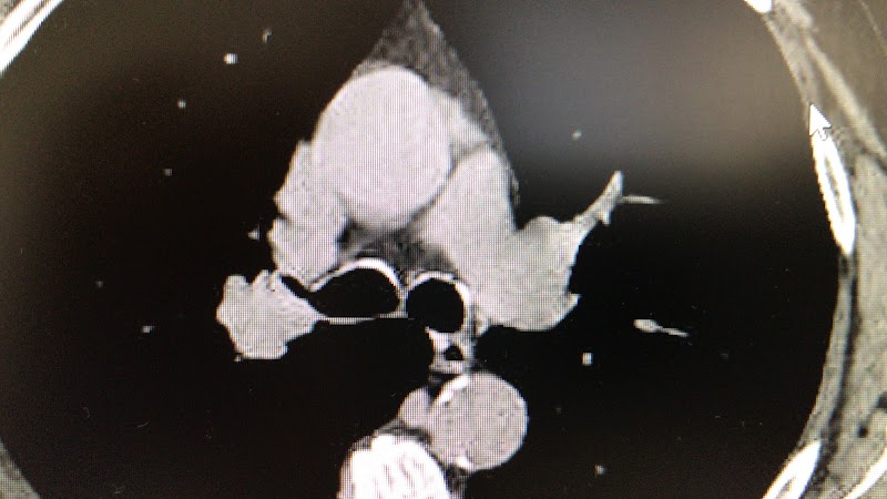 Imagen de Clinica Dr. German Saez Roca, Neumologo-apnea del Sueño-asma Grave