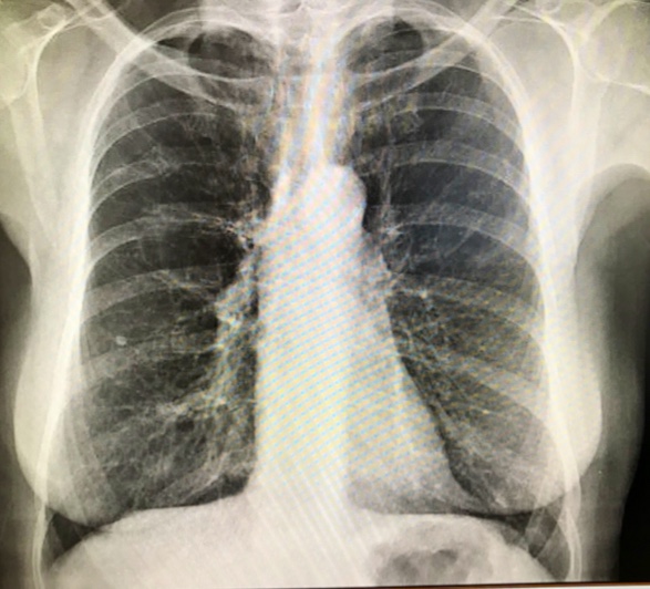 Imagen de Clinica Dr. German Saez Roca, Neumologo-apnea del Sueño-asma Grave