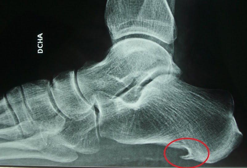 Imagen de Clínica Podològica Hiroc