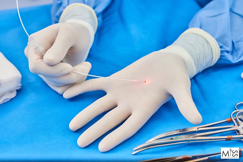 Imagen de Cirugía Laparoscópica Sevilla – Miss