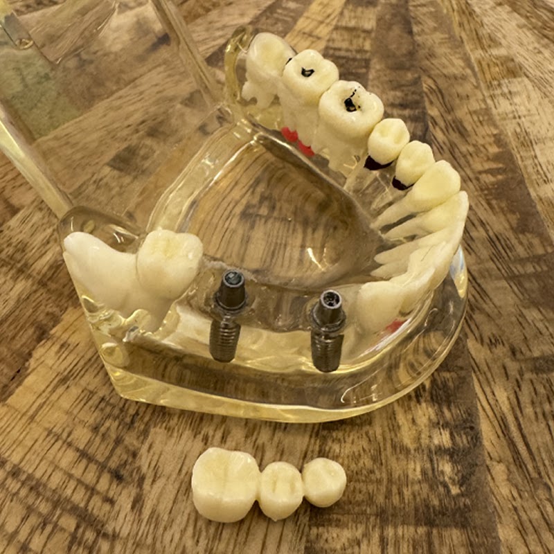 Imagen de negocio en Clínica dental en Elx