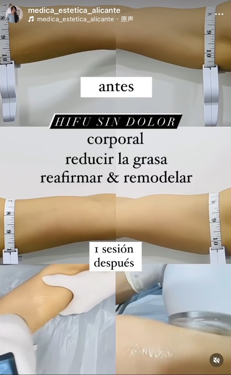 Imagen de negocio en Tratamiento facial en Provincia de Alicante