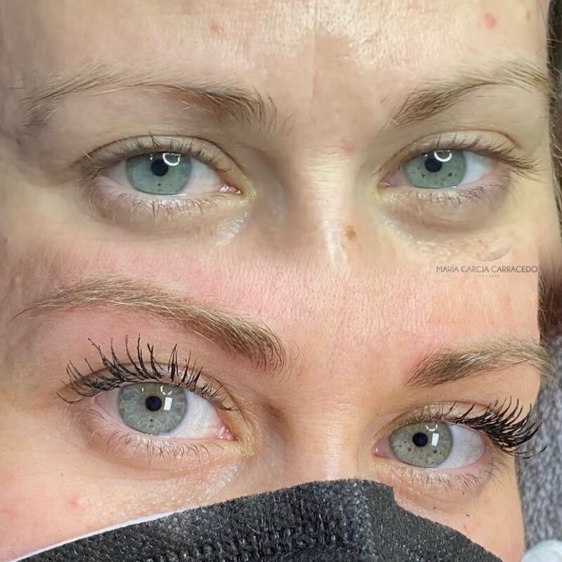 Imagen de Micropigmentación // María García Carracedo
