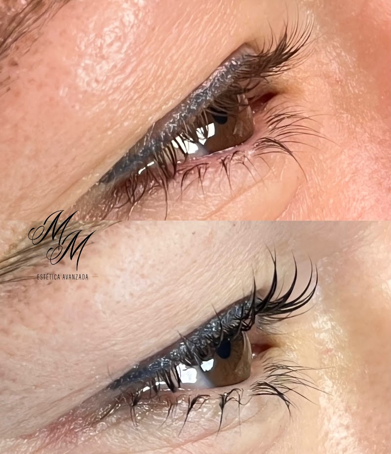 Imagen de Mireia Martínez Estética Avanzada