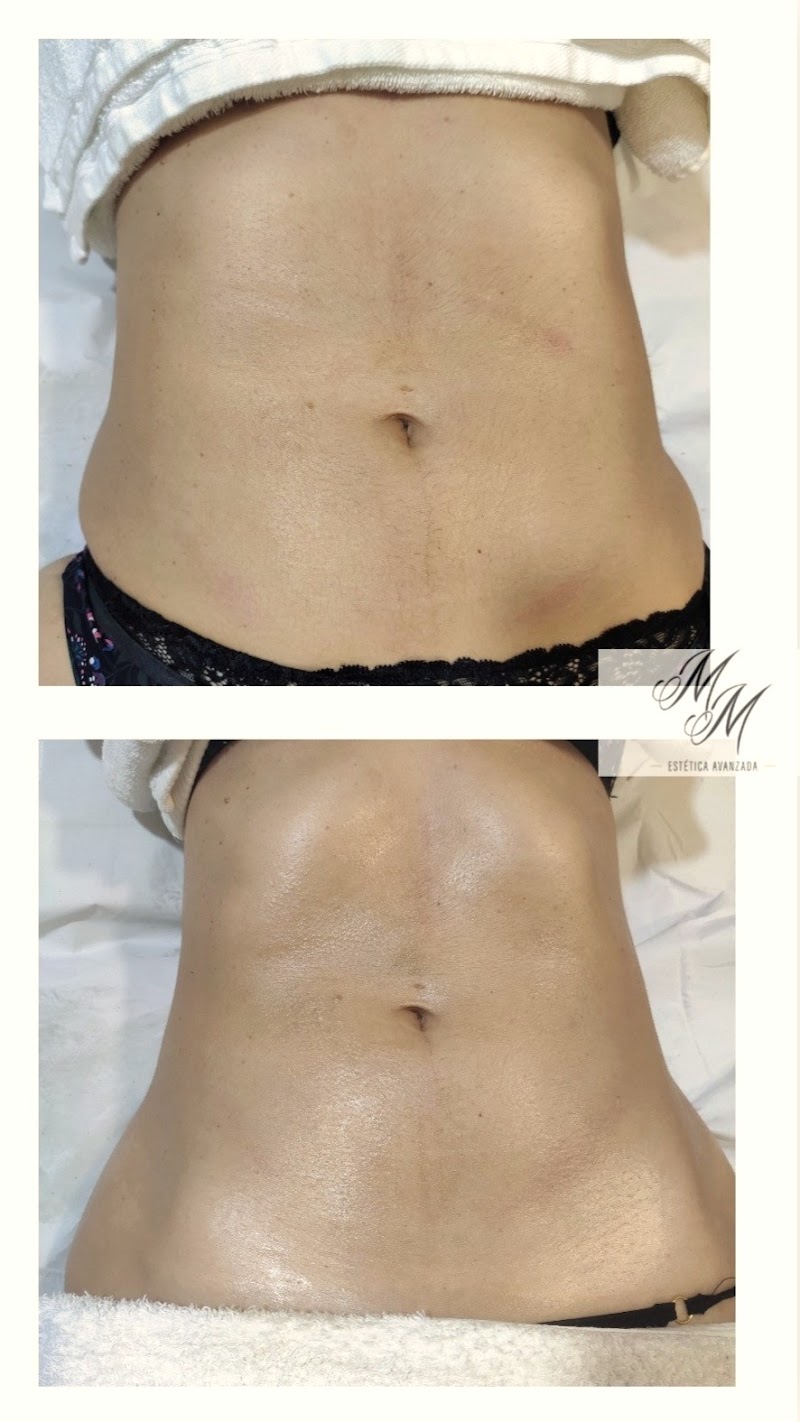 Imagen de Mireia Martínez Estética Avanzada