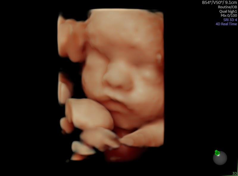 Imagen de Ecografía 5d, Hiperrealismo y 8k – Carme Diaz Ginecología