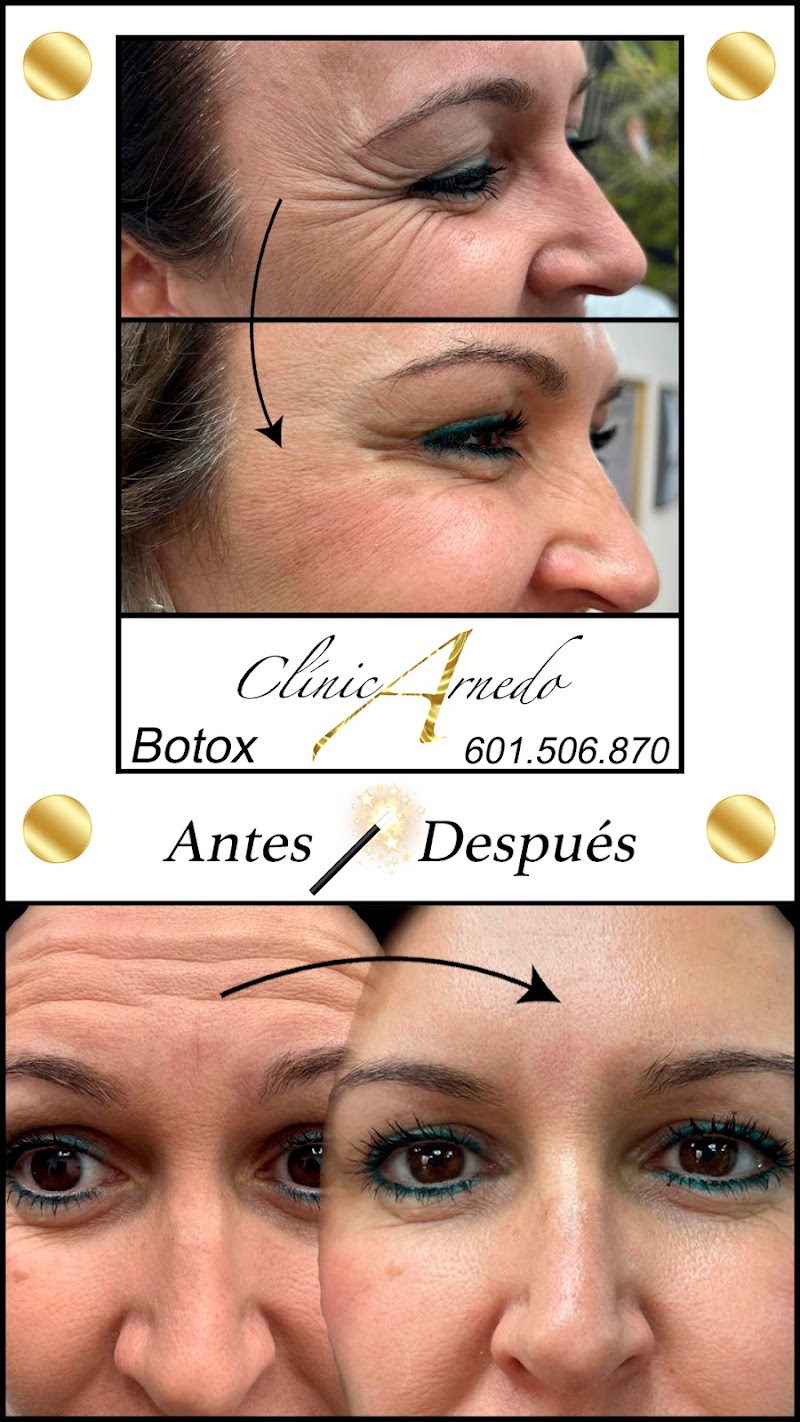 Imagen de Clinicarnedo Centro Médico Estética