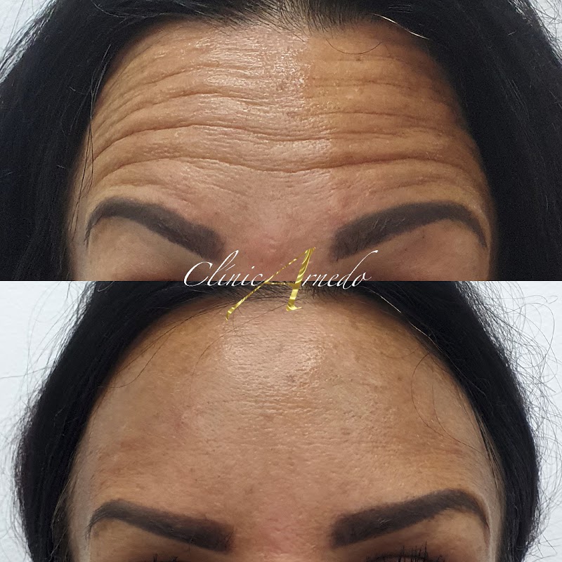 Imagen de Clinicarnedo Centro Médico Estética