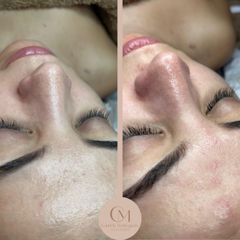 Imagen de Candela Monteagudo Estetica Avanzada