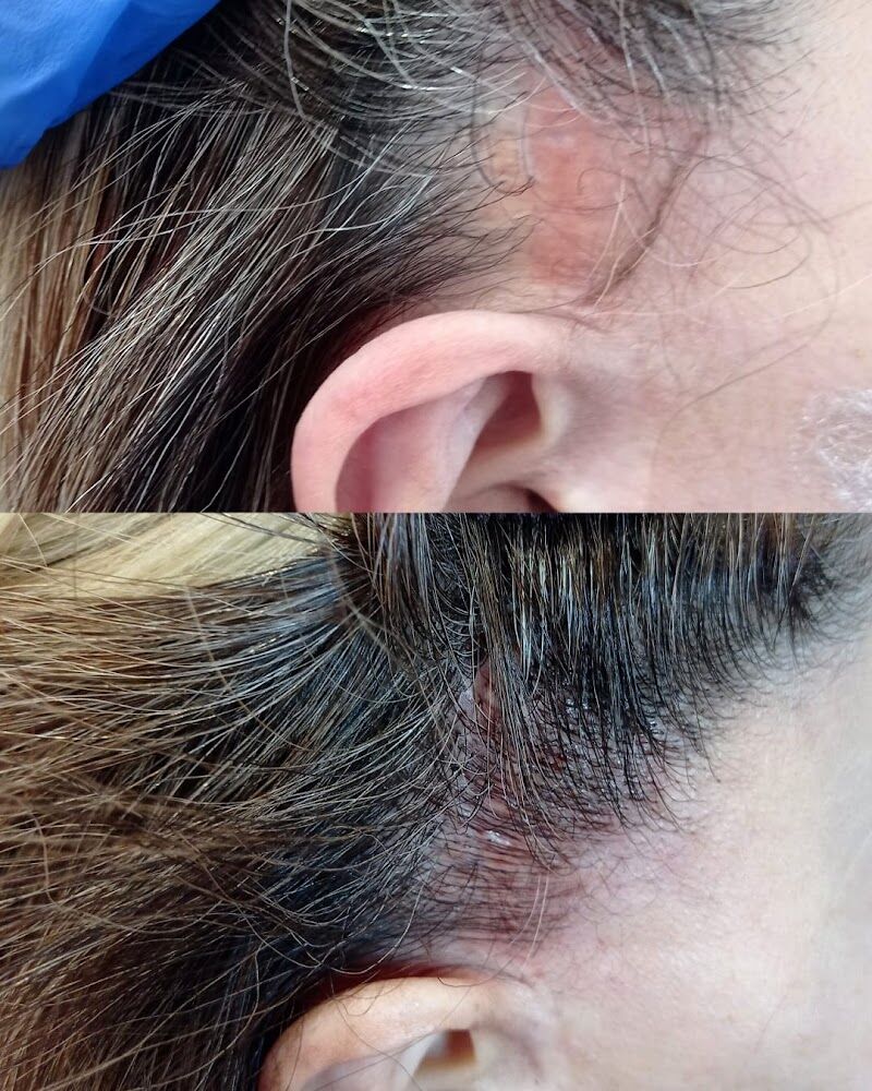 Imagen de Micropigmentacion Lupe Dura