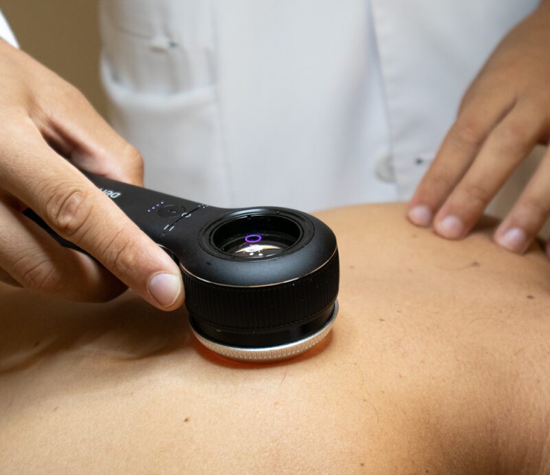 Imagen de Dermadenia