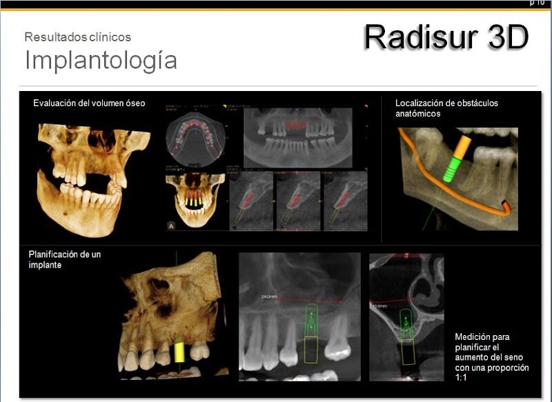 Imagen de Radisur 3d. Sevilla