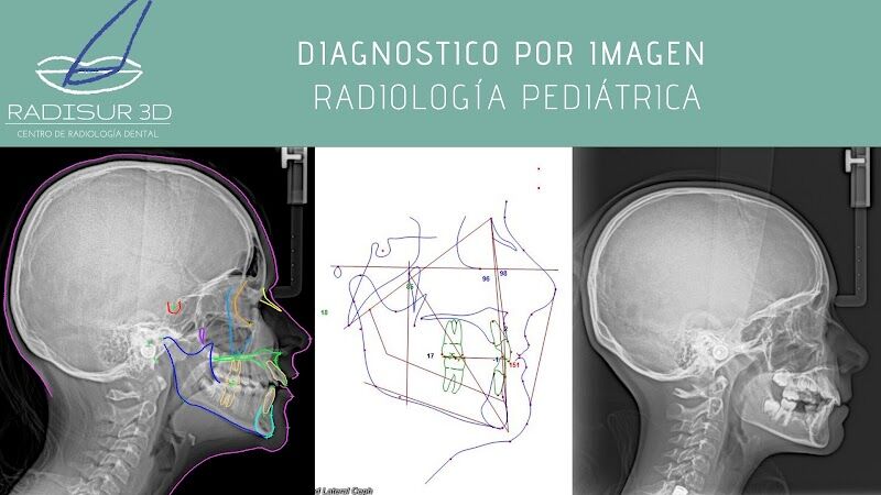 Imagen de Radisur 3d. Sevilla