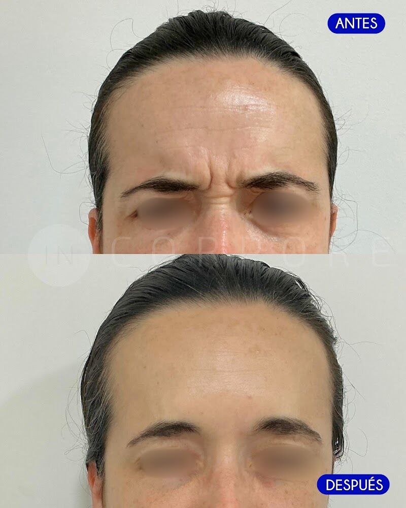 Imagen de Clínica Médico Estética Incorpore Málaga- Dr. Juan Enrique Pérez Enríquez