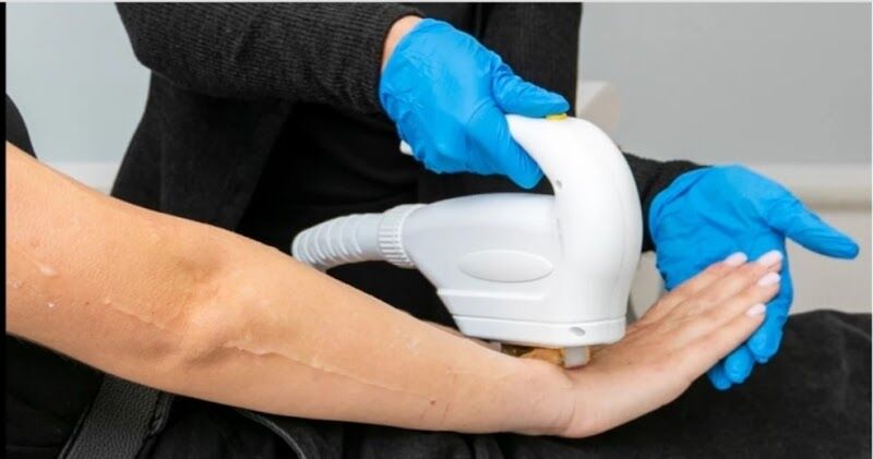 Imagen de Cocoa Laser