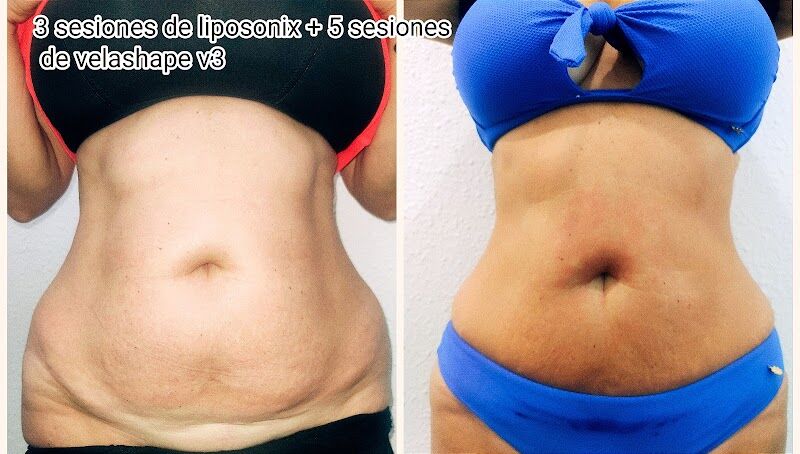 Imagen de Centro Estética Avanzada Lorena Reyes