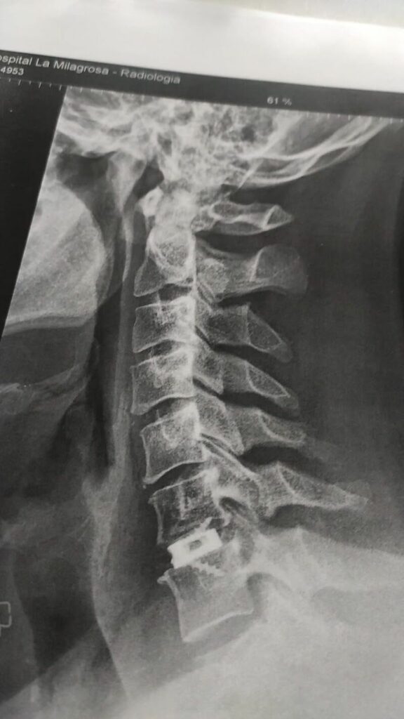 Imagen de Vértebra2