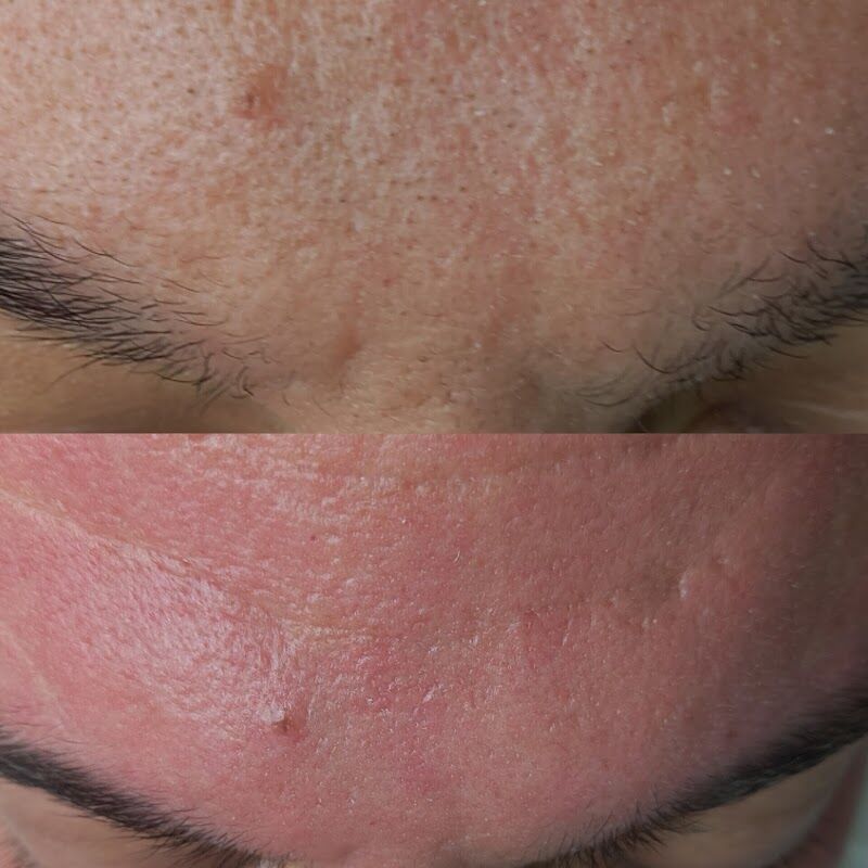 Imagen de Aesthetic Agudo