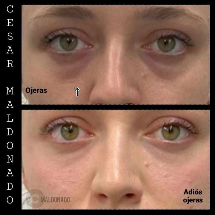 Imagen de Dr. Cesar Maldonado Médico Estético