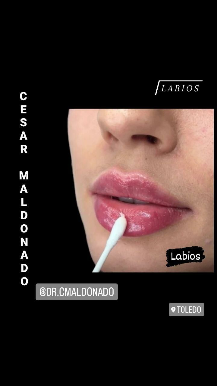 Imagen de Dr. Cesar Maldonado Médico Estético