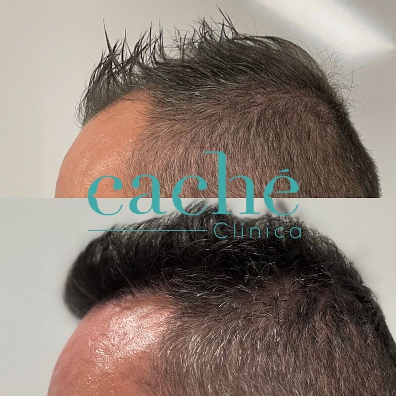 Imagen de Clínica Caché